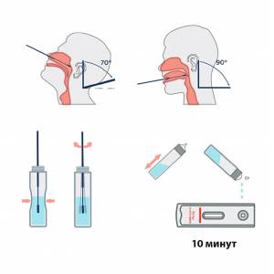 Комбинированный экспресс-тест на COVID-19 и гриппа А/В 